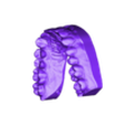 UpperJaw Model.stl Dental Model With 10 Veneers and Articulator