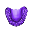2024-01-08_99999-001-17-16-15-14-13-12-11-21-22-23-24-25-26-27-bridge_slm_cad.stl UPPER & LOWER TEETH