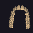 upperjaw.dentalCADscreenshot.png 🔥DA507 ExoCad Teeth Library 2026