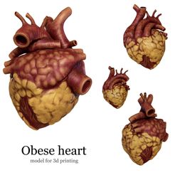 0E9E64B8-E326-4660-AD8F-1BDC5132BE44.jpeg Anatomical model of obese heart
