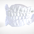 Screenshot_16.png Digital Try-in Full Dentures for Injection Molding