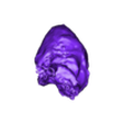 Heterotaxy.stl 先天性心脏病分类（CHD）