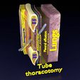 thorax-thoracotomy-thoracocentesis-intercostal-nerve-block-3d-model-blend-69.jpg thorax thoracotomy thoracocentesis intercostal nerve block 3D model
