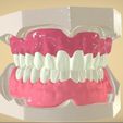 digital-full-dentures-3d-model-stl.png7.jpg STL file Digital Full Dentures・3D printer model to download