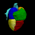 13.png 3D Heart Model - generated from real patient