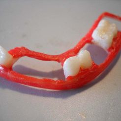 DSCN0285.JPG Free STL file dental partial dentures・3D printable design to download