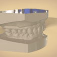Screenshot_16.png Digital Orthodontic Study Models with Virtual Bases