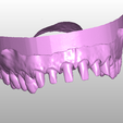 Imagen3.png Complete dental model