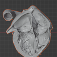 6.png 3D Model of Heart (2.3.4.5 chamber view) - 4 pack