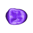 5.stl dental partial dentures