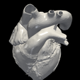 2.png 3D Model of Heart (apical 4 chamber plane)