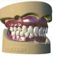 29.png Digital Full Dentures with Combined Glue-in Teeth Arch