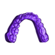 output_model_Lower Jaw.stl Dental models with removable dies