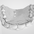 Fix-lingual-retainer-2.png High resolution Fix Lingual Retainer Dental Appliance