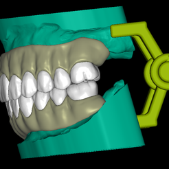 7.png Full Denture Model Upper and Lower