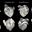 4pack.png 3D Model of Heart (2.3.4.5 chamber view) - 4 pack