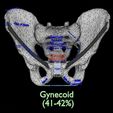 pelvis-types-hip-bone-labelled-detailed-3d-model-7ff30337be.jpg Pelvis types hip bone labelled detailed 3D model