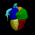 6.png 3D Heart Model - generated from real patient