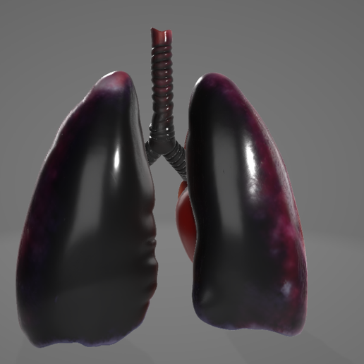 🫁 Smoker’s Damaged Human Lungs Model・ STL File for 3D printing・Cults