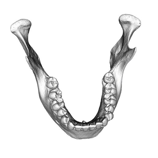 High-Resolution Human Mandibla Models – Realistic & Crystalline Replica