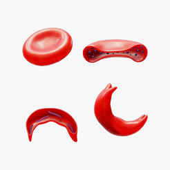 NS_Tumbnail.png Cross Section of Normal vs Sickle Red Blood Cell