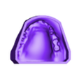 dental model - open bite.stl dental model - open bite