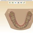 Screenshot_7.png Digital Orthodontic Study Models with Virtual Bases