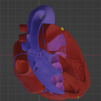 10.png 3D Model of Heart with Transposition of the Great Arteries, long axis view