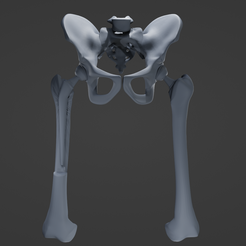 h1.png Hip Replacement model