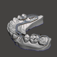 Captura-de-Tela-26.png Grade PPR (Roach) - Odontologia Modelo Didático
