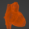 12.png 3D Model of Heart with Tetralogy of Fallot (ToF)