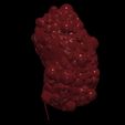 1.jpg 3D Model of Polycystic Kidney