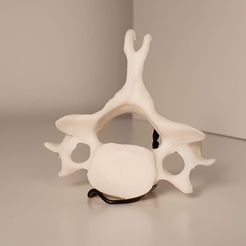 20210809_183416.jpg cervical human vertebrae