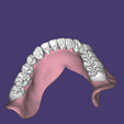 Capture2.png Upper and lower full dentures. Teeth and bases