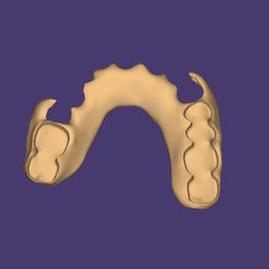 Clipboard-2024-06-11-20-45-46.jpg DIGITAL FLEXIBLE PARTIAL DENTURE (upper base + artificial teeth)
