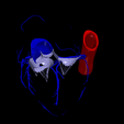 6.png 3D Model of the Heart with Tetralogy of Fallot, parasternal long axis