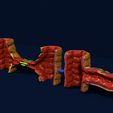 ps14.jpg 3D Angiogenesis NEW BLOOD VESSEL FORMATION