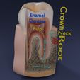 image-0033.jpg Corte esquemático de los dientes etiquetado