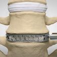 2022-04-19-at-09-13-26.jpg Cage XLIF (Extreme Lateral Interbody Fusion )