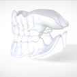 Screenshot_17.png Digital Try-in Full Dentures for Injection Molding