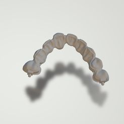 interlocker-attachment.jpg STL file Dental Prosthesis metallic frameworks with attachment・3D printer design to download