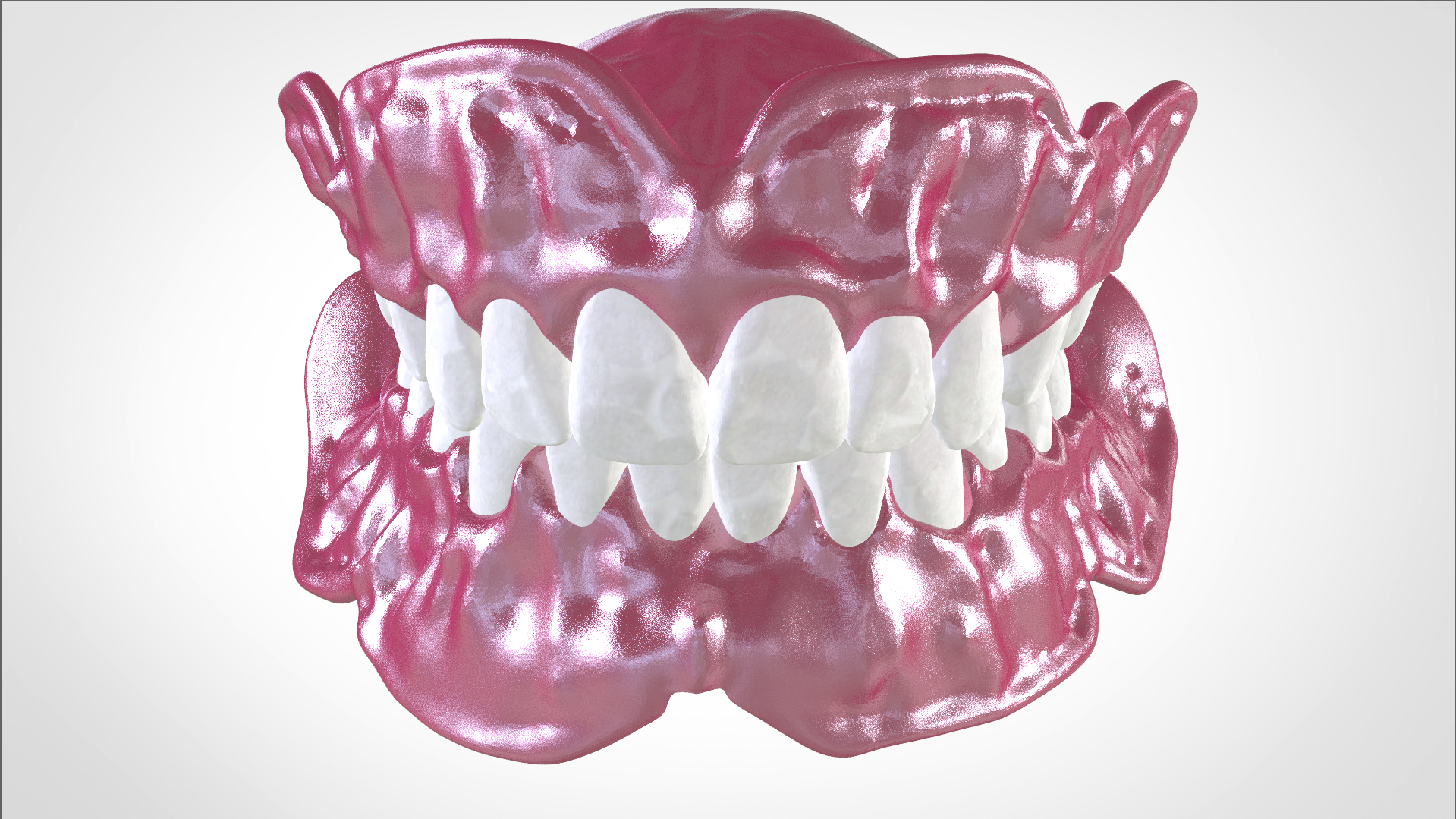 Screenshot_18.png Download OBJ file Digital Full Dentures for Gluedin Teeth with Manual Reduction • 3D printable design, LabMagic3DCAD