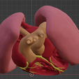 1.png 3D Model of Transposition of the Great Arteries Open Duct