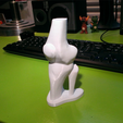 Capture_d_e_cran_2015-12-16_a__19.21.34.png STL-Datei Knee joint kostenlos・3D-Druckvorlage zum Herunterladen