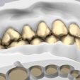 30.jpg 3D Dental Jaws Replica with Detachable Teeth
