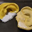 IMG-20221111-WA0043.jpg Human Ear 1
