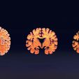 ps45.jpg Alzheimer Disease Brain coronal slice