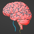 3.png 3D Model of Brain and Aneurysm