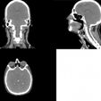 4.jpg Halloween Skull Earphones/Earpods Holder Storage - 3D printable from CT Scan