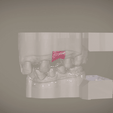 Screenshot_13.png Digital Implant Model with Soft Tissue